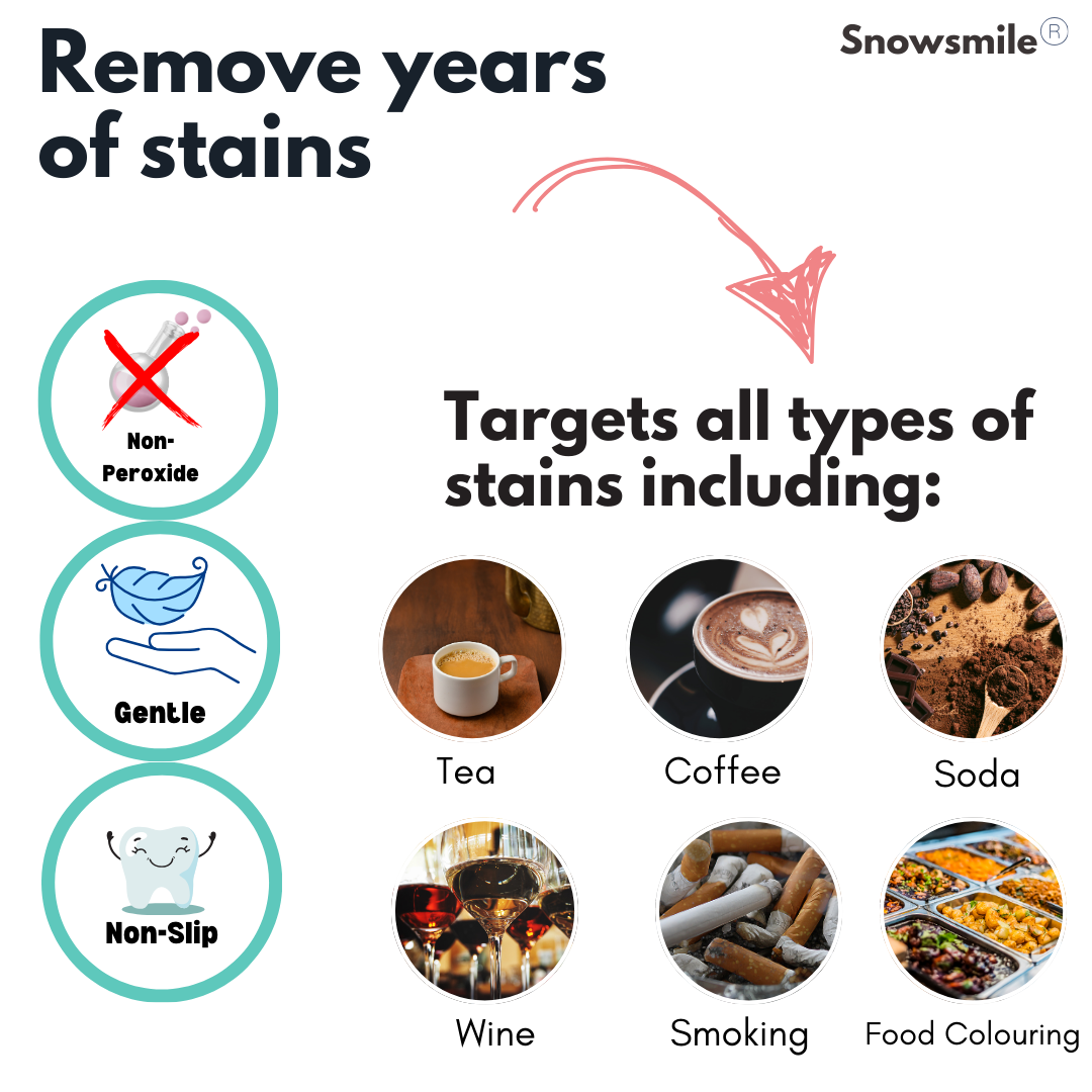 SnowSmile peroxide-free whitening strips — view 4
