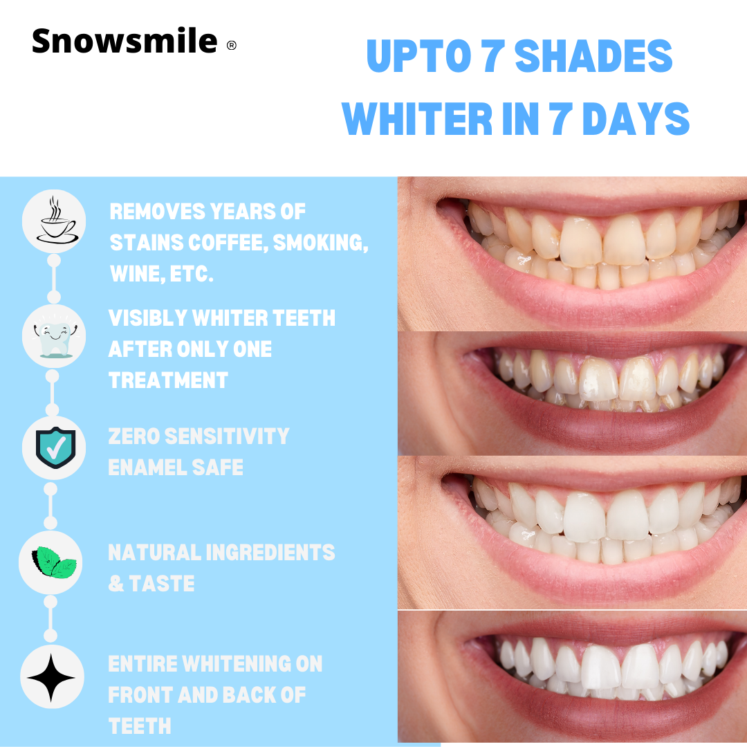 SnowSmile peroxide-free whitening strips — view 5